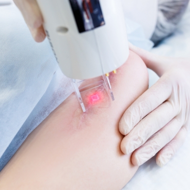 Scar Removal